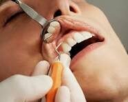 Dental hygienist working on a patient